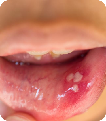 Saliva Testing
